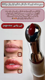 حجم دهنده لب پیجوین